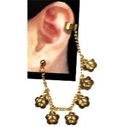 ARETE DE METAL
