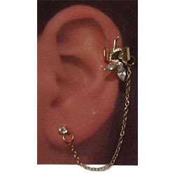 ARETE DE METAL